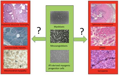 Myogenic Cell Transplantation in Genetic and Acquired Diseases of Skeletal Muscle